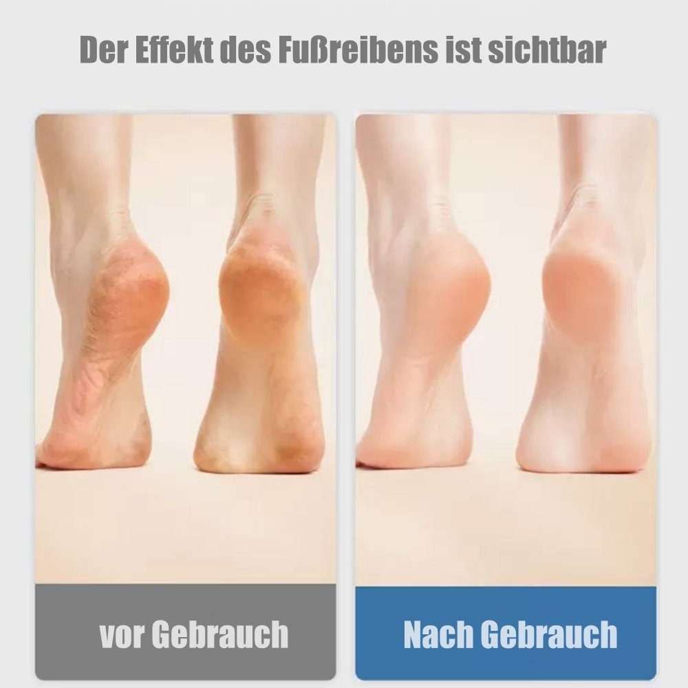 Lamon Gesichtshaarentferner Haarentferner,Ruby Nano Haarentferner,Haarentfernung Ohne Rasieren, WiederverwendbarDer, Verabschieden Sie sich von Rasierschnitten und schmerzhaftem