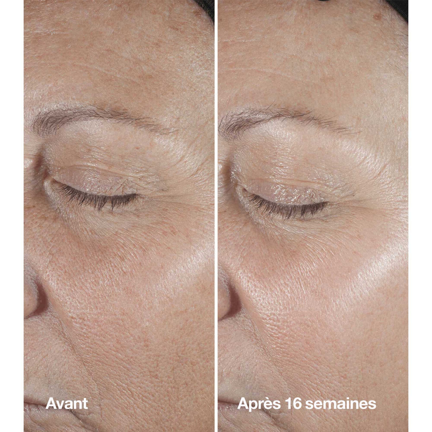 Clinique Smart Clinical Serum Sérum Correcteur Anti-Rides