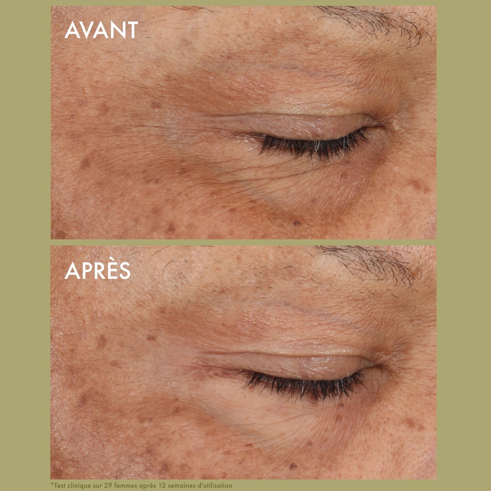 origins Plantscription™ Crème Yeux Correction Rides au Rétinol Encapsulé