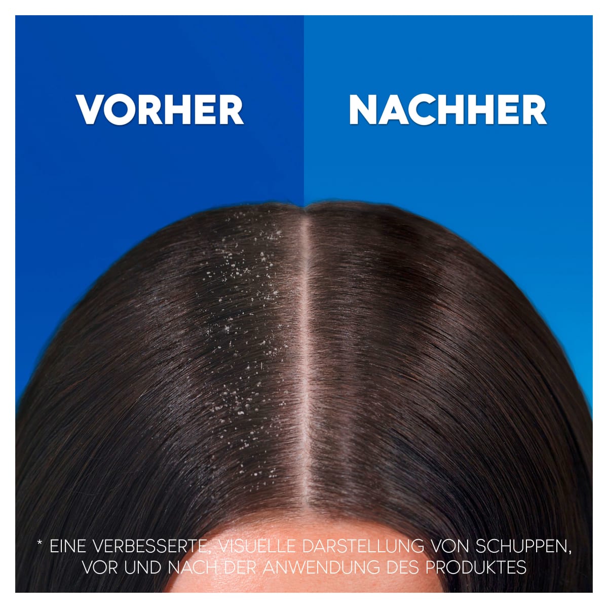Shampoo Anti-Schuppen Apple Fresh, 300 ml