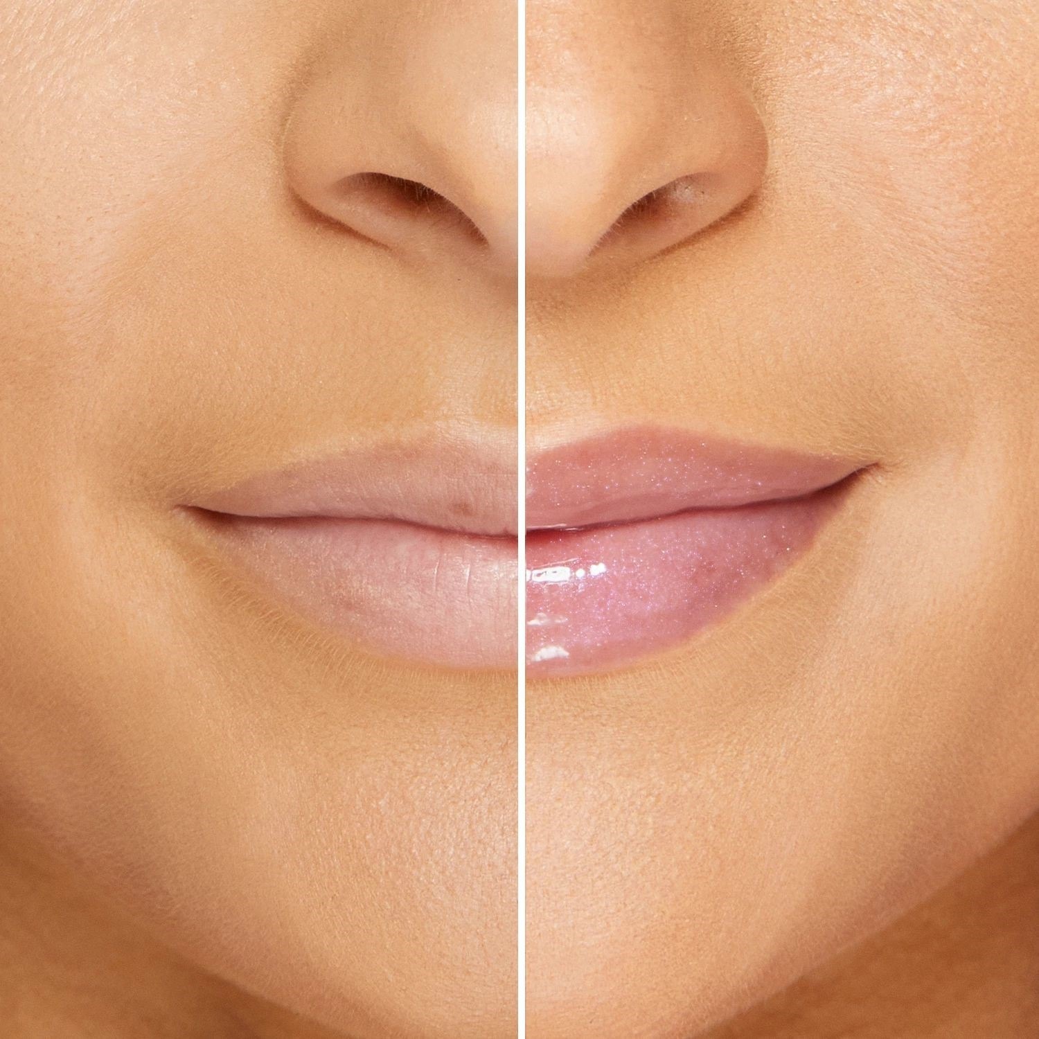 Lip Injection Maximum Plump