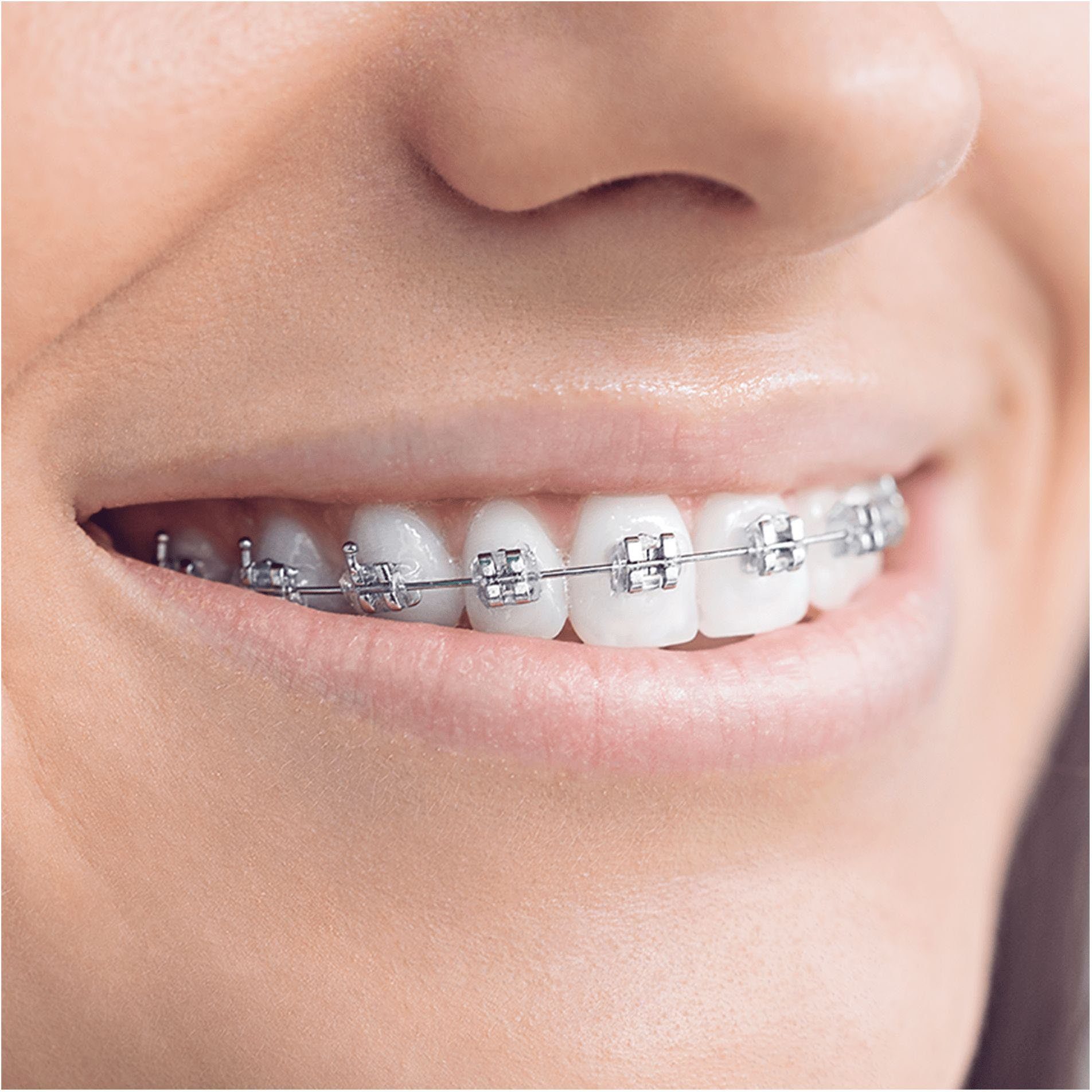 Oral-B Aufsteckbürsten Interspace