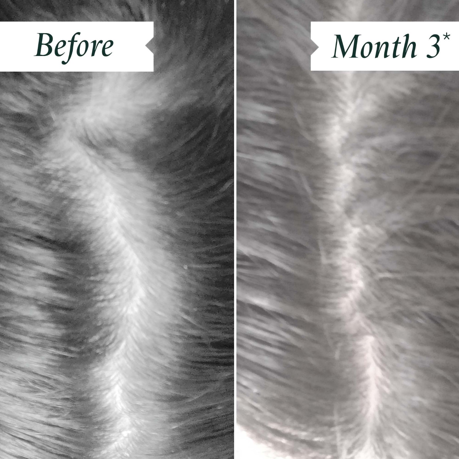 Density Preserving Scalp Drops
