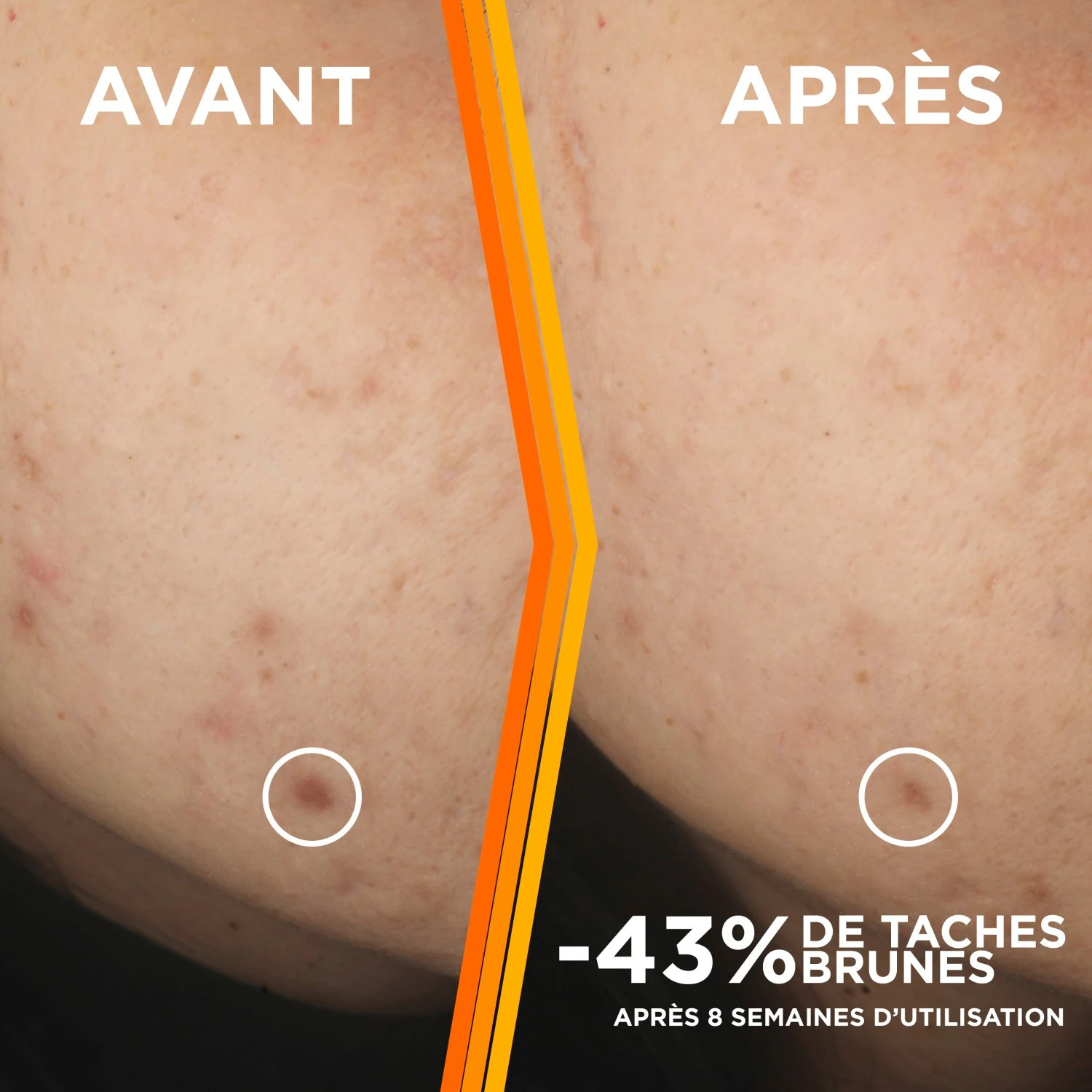 Garnier vitamin C serum protiv tamnih mrlja