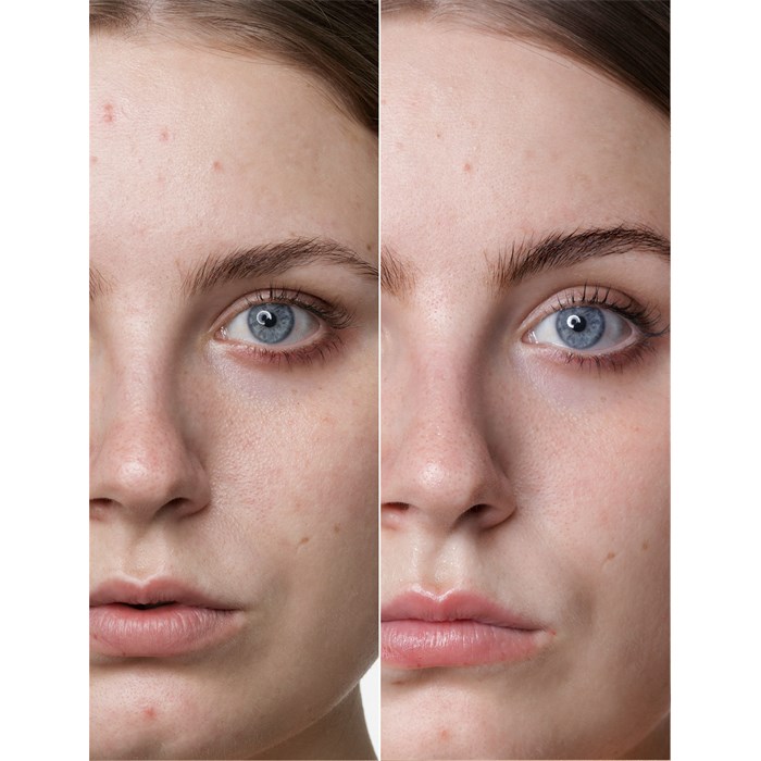 Hyaluronic Acid Power Serum Ampoules