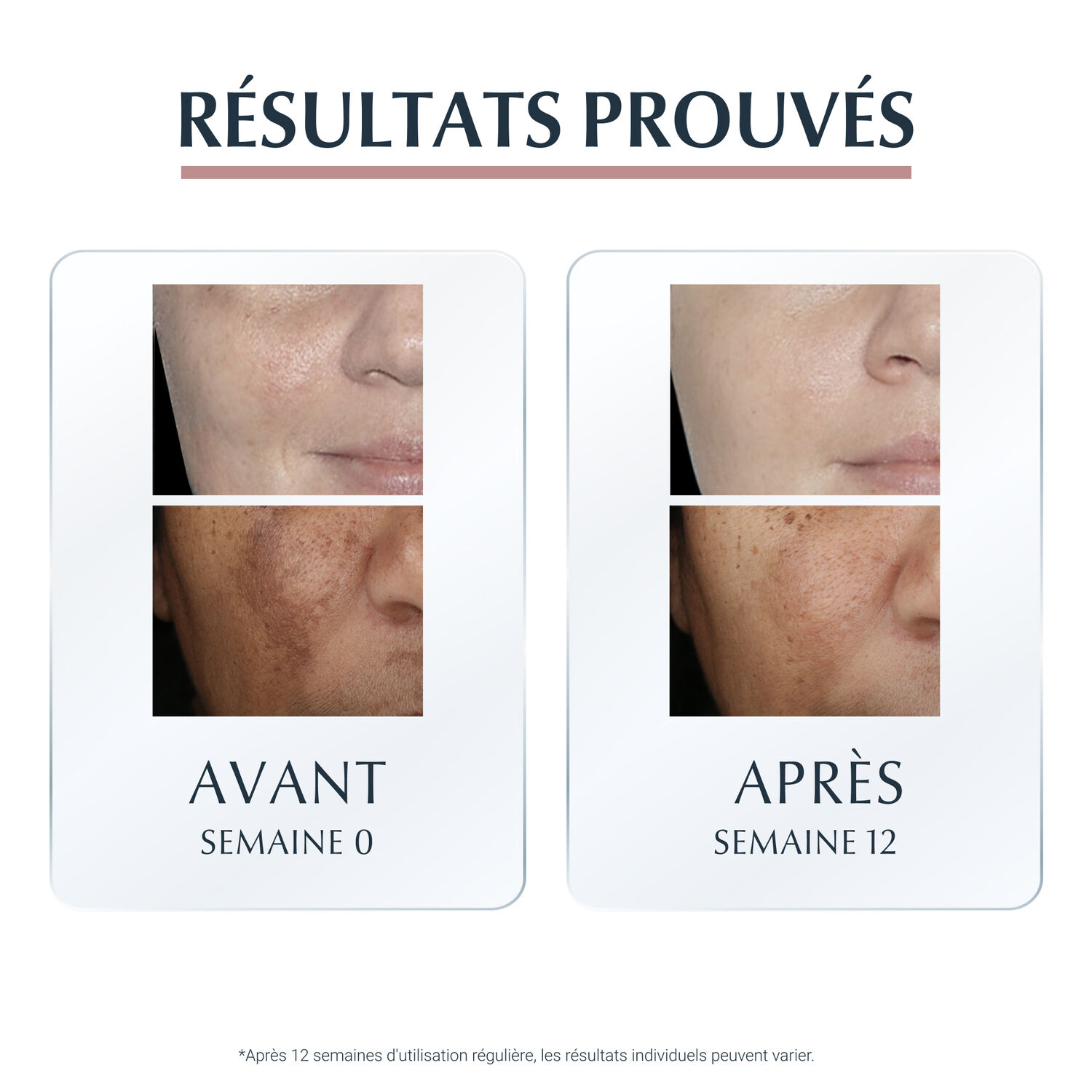 Eucerin Anti-Pigment Sérum Duo Anti-Tâches - Tous Types de Peaux