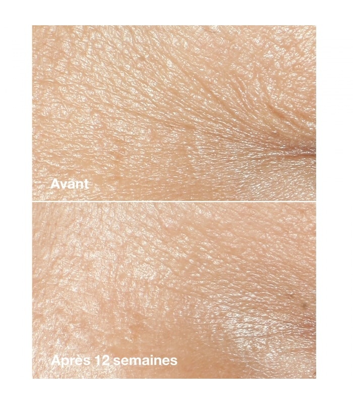 Clinique-SMART CLINICAL REPAIR-Crème riche correctrice anti-rides