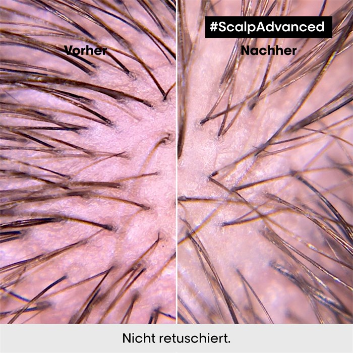 Anti-Discomfort Intense Soother Treatment