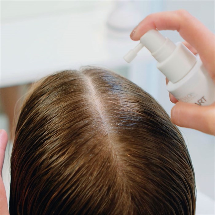 Anti-Hair Loss Direct Spray