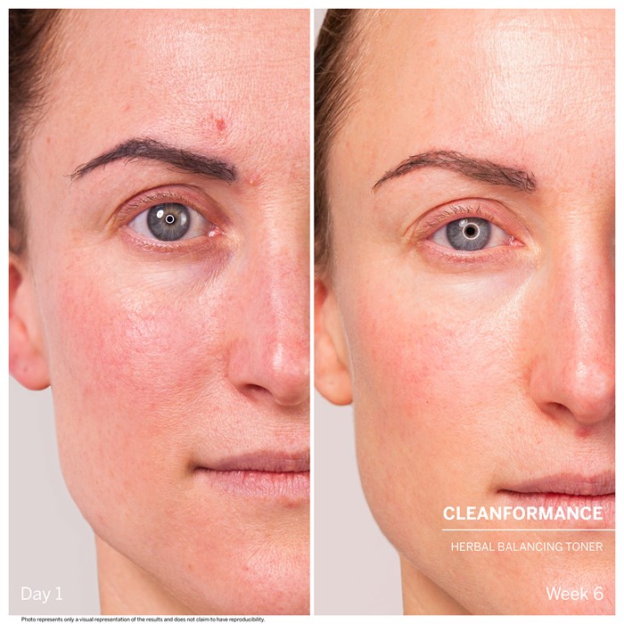 Herbal Balancing Toner