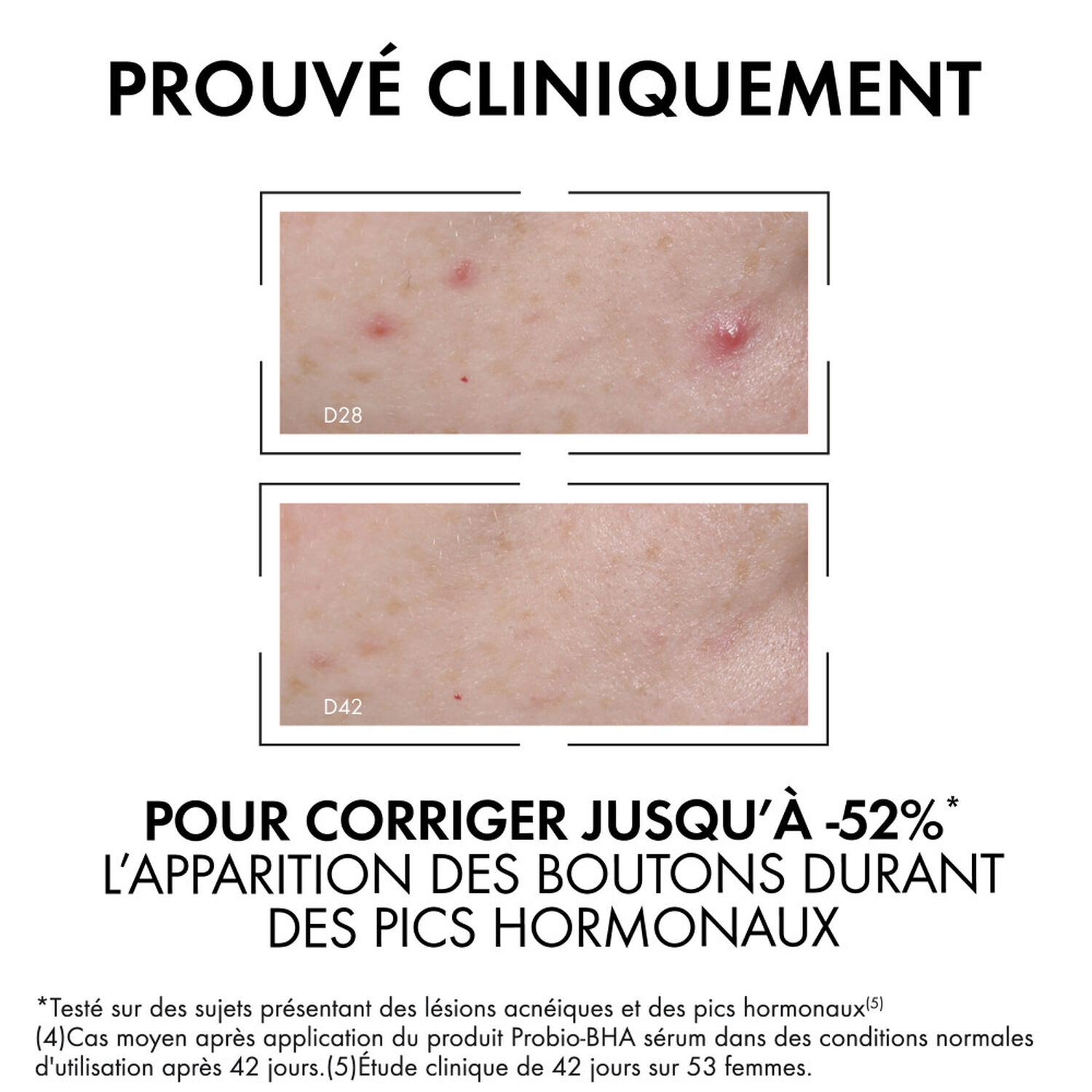 Vichy Normaderm Sérum Anti-Imperfections Probio-Bha - 30 ml
