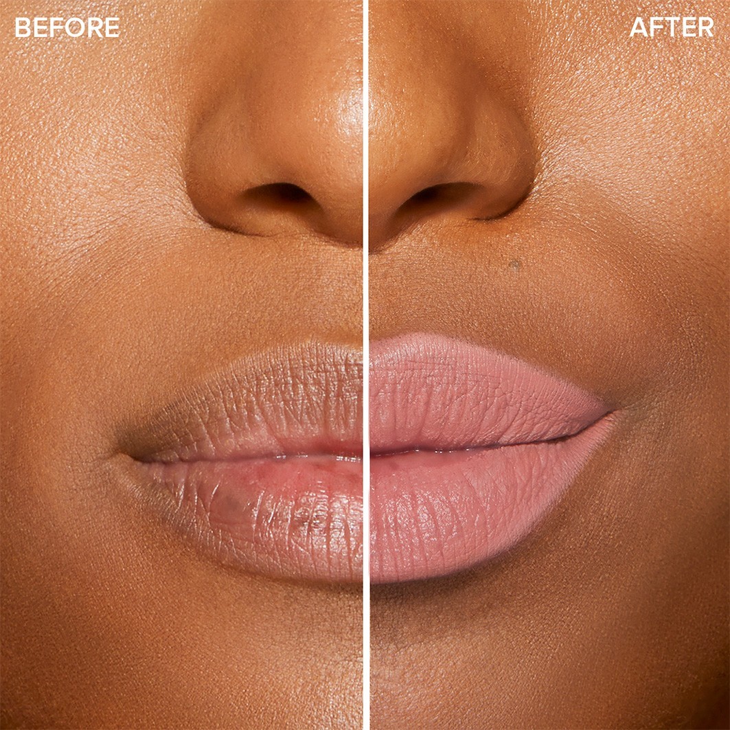 Extreme Lip Shaper