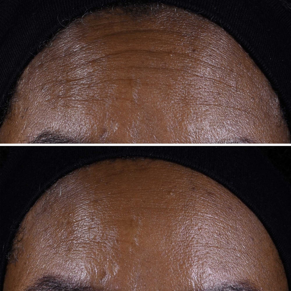 Clinique Smart Clinical Repair™ Crème Liftante Crème Anti-rides Visage + Cou