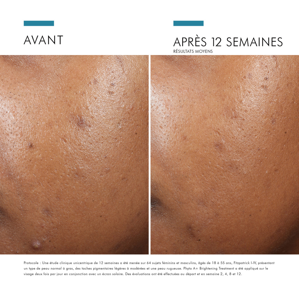 SkinCeuticals PHYTO CORRECTIVE Gel-crème hautement concentré pour illuminer et corriger les imperfections