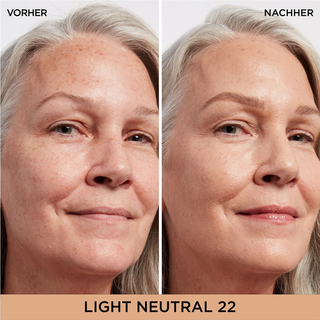 Bye Bye Dark Spots