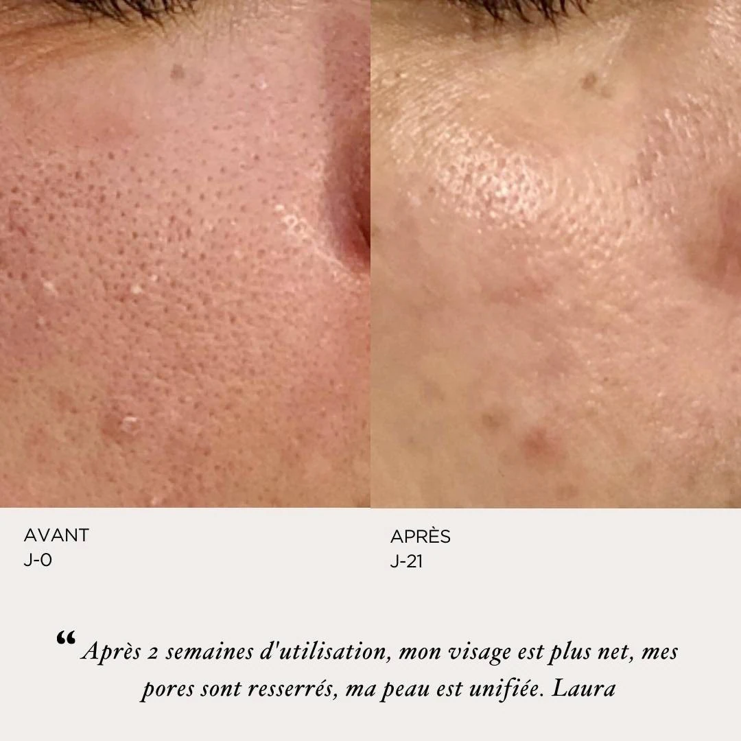 ORYZA LAB Serum za usavršavanje