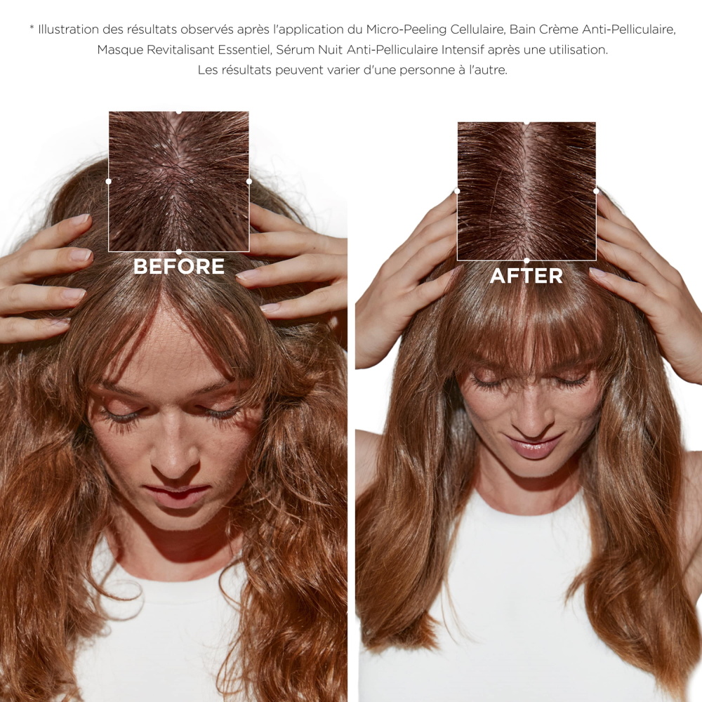 Kérastase Symbiose Bain Crème Anti-Pelliculaire 250ml Shampoing