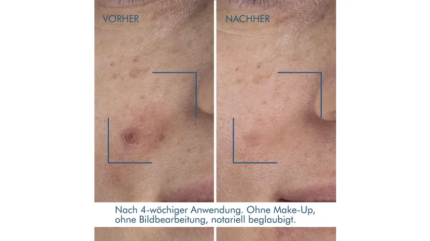BIOTHERM Serum Blue Retinol Resurface & Repair  Night 30 ml
