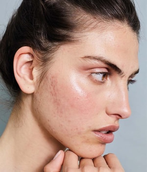 CAUDALIE Vinopure Skin Perfecting Serum Gesichtsserum 30 ml