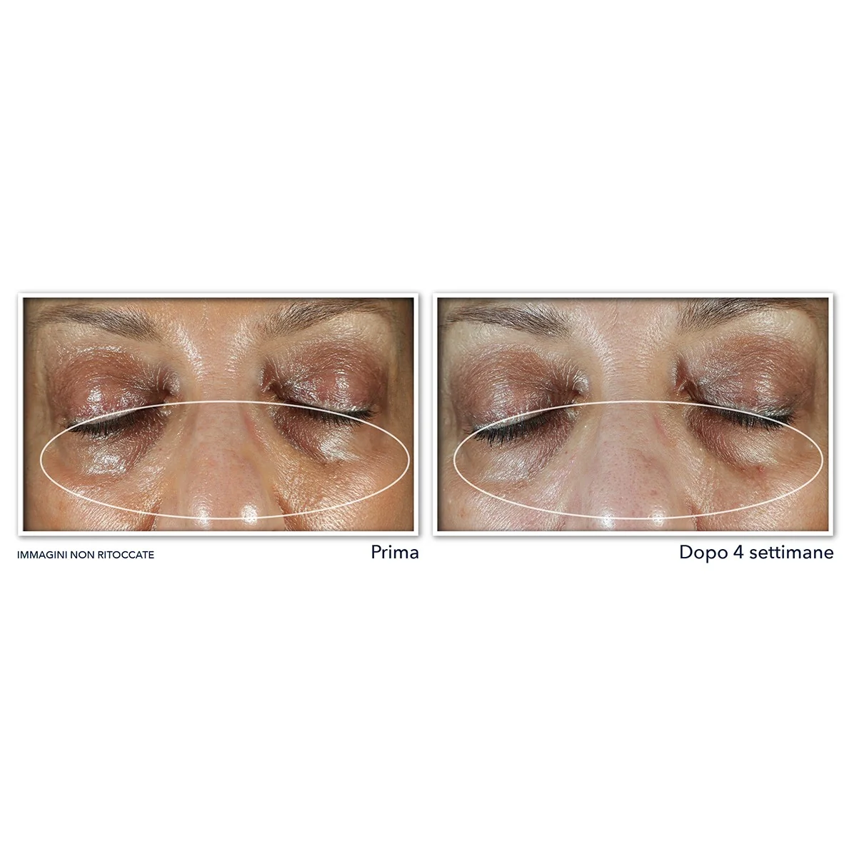Cremă contur ochi Multi Correxion Uniform Tone + Lift - Contur ochi antirid