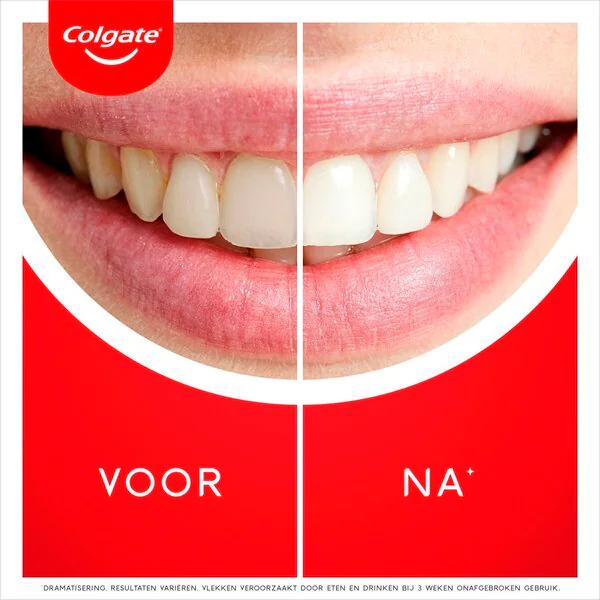 Colgate Max White Ultra Freshness Pearls -valkaiseva hammastahna 75ml - Valkaiseva