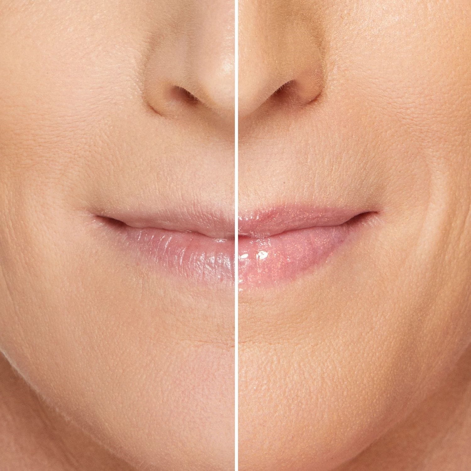 Lip Injection Maximum Plump
