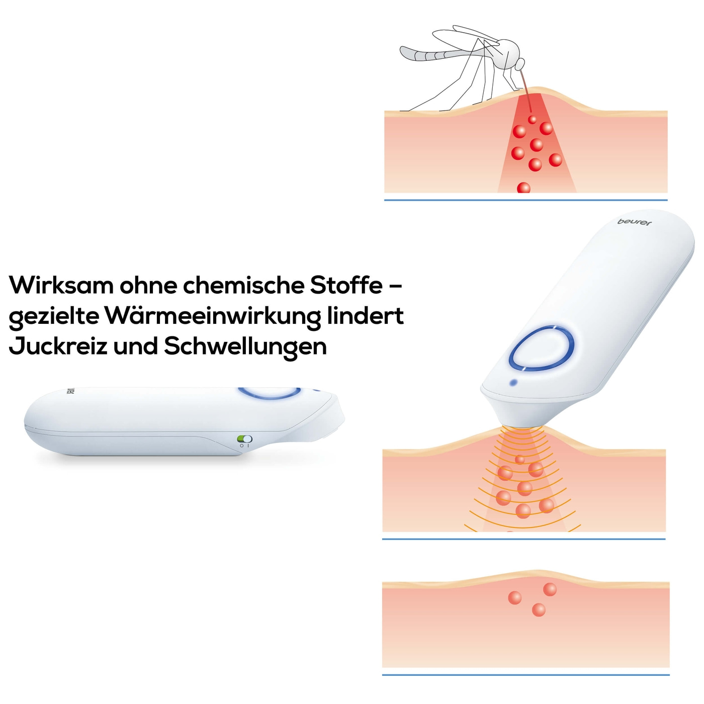 Beurer Insektenstichheiler BR 60-Stichheiler gegen Juckreiz & Schwellungen mit 2 Programmen