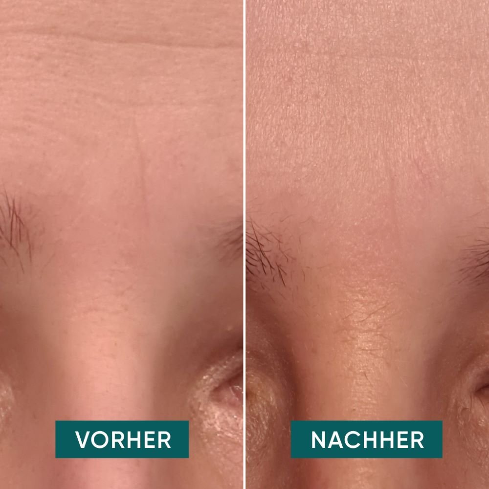 Apricot Beauty Pads Gesicht Pads mit Hyaluron