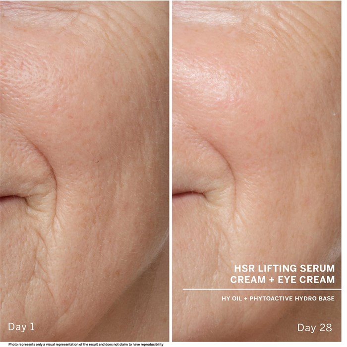 Anti-Wrinkle Cream