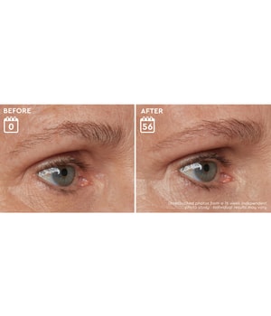 ANASTASIA Beverly Hills Brow Genius Augenbrauenserum-2 ml