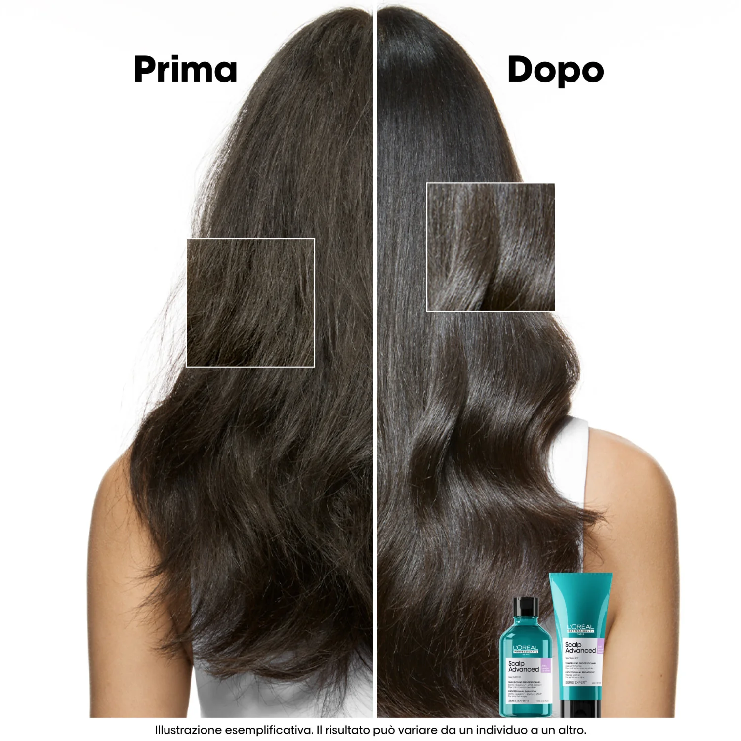 EXPERT SERIES New Scalp Advanced Anti-Obehag Schampo - Refill - Rengörande Schampo, Avgiftande Schampo