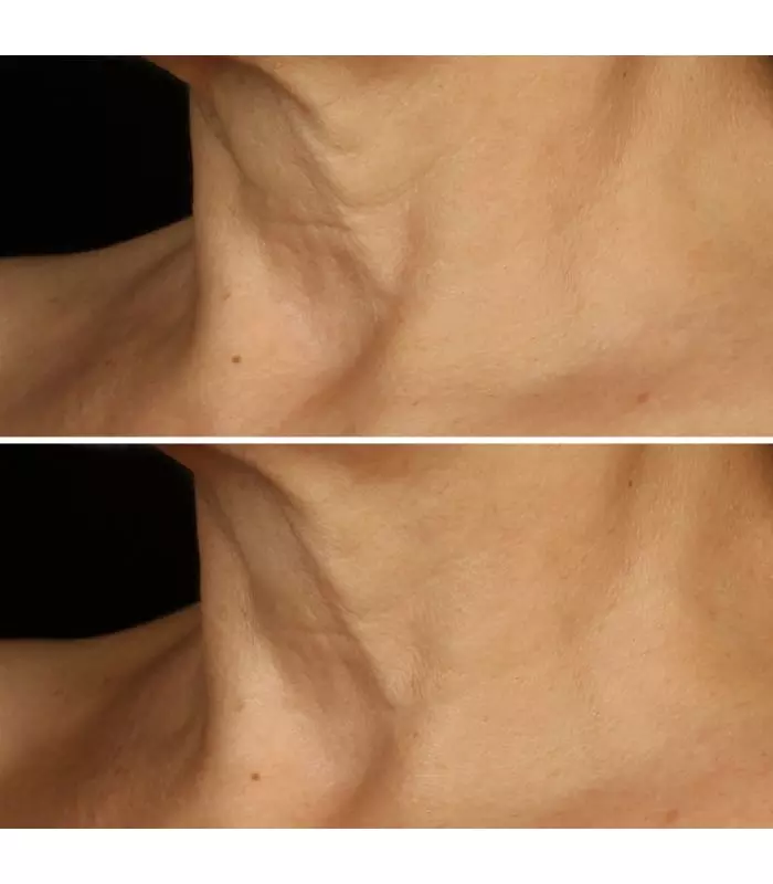 SMART CLINICAL Smart Clinical Repair™ Crème Liftante Visage + Cou