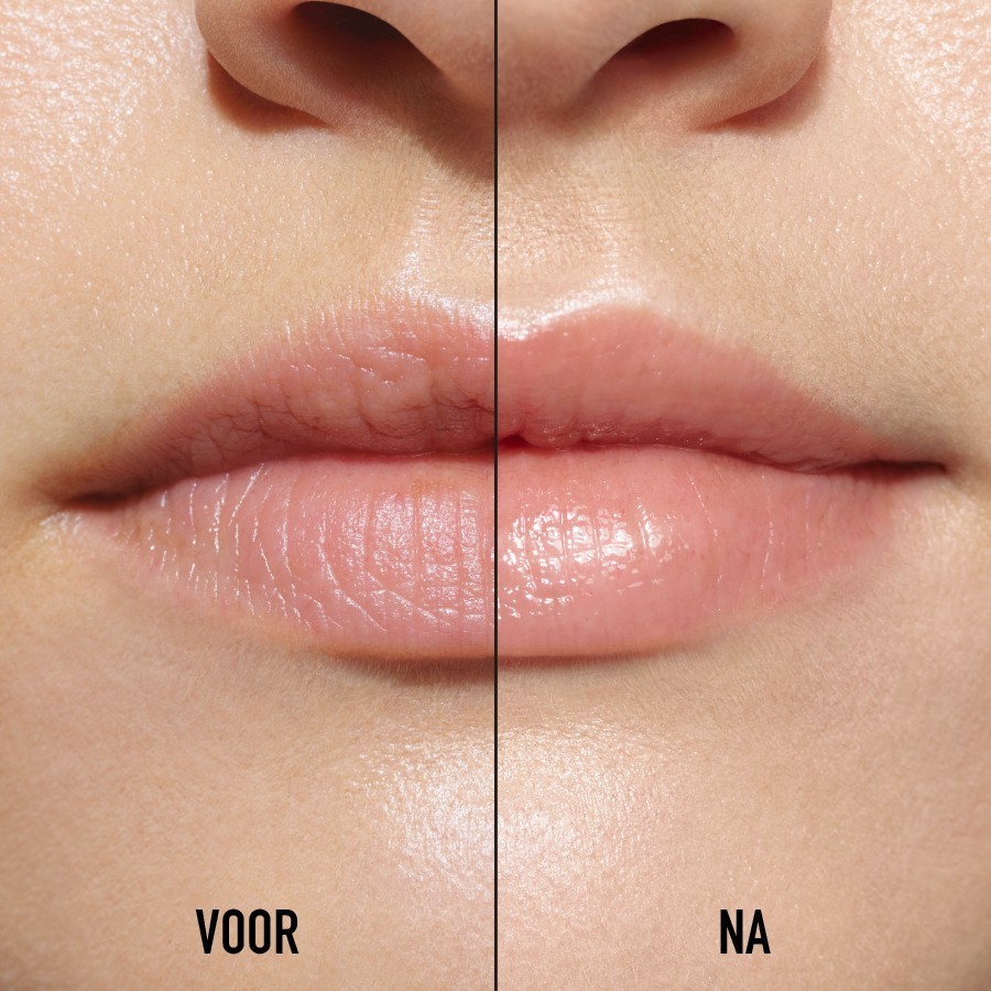 Lip Maximizer Serum