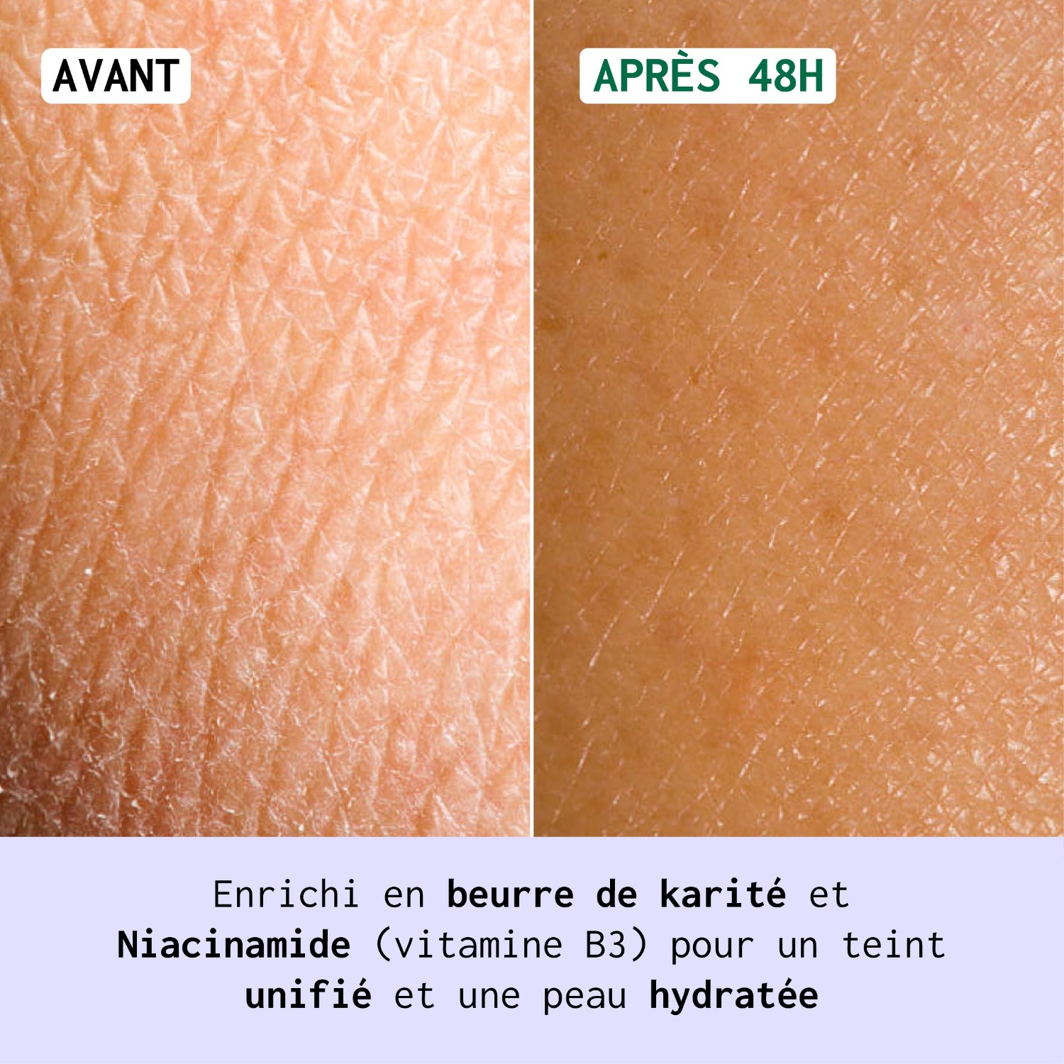 Nubiance Lozione Corpo Anti-Macchie HRB-3
