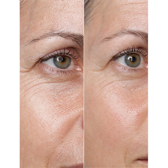 Peptides Power Serum Ampoules