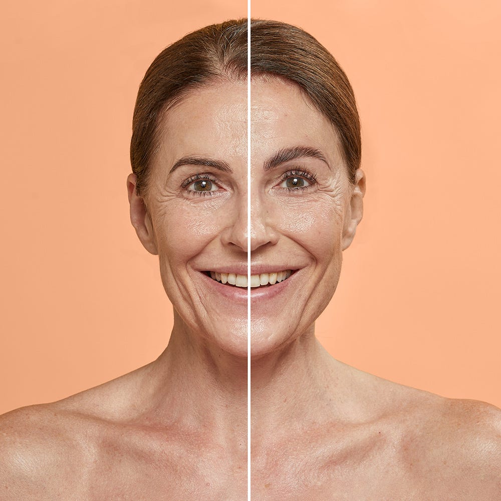 Combinal - Brow Lifting Starter Kit