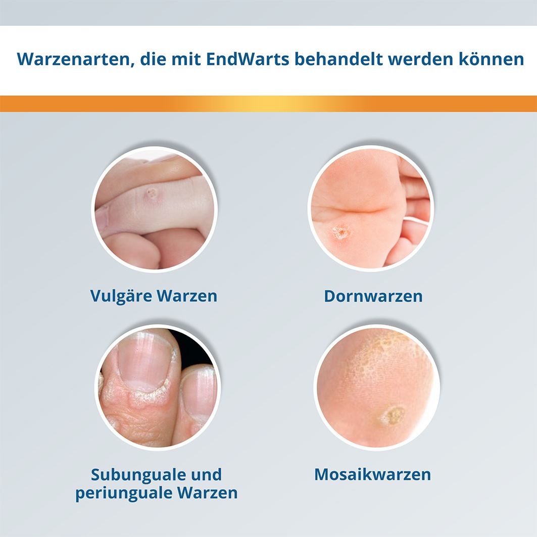 ENDWARTS Classic Lösung