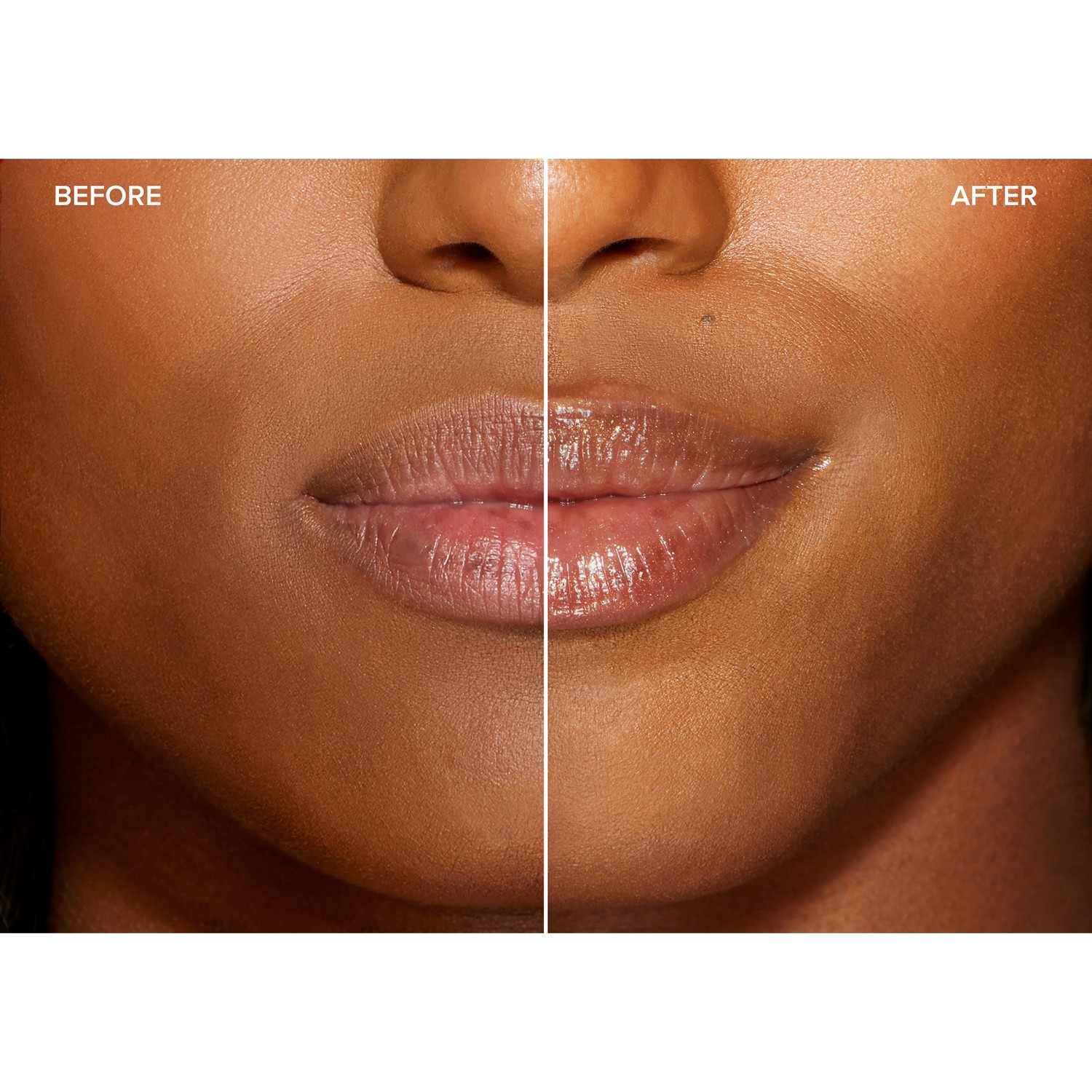 Lip Injection Maximum Plump
