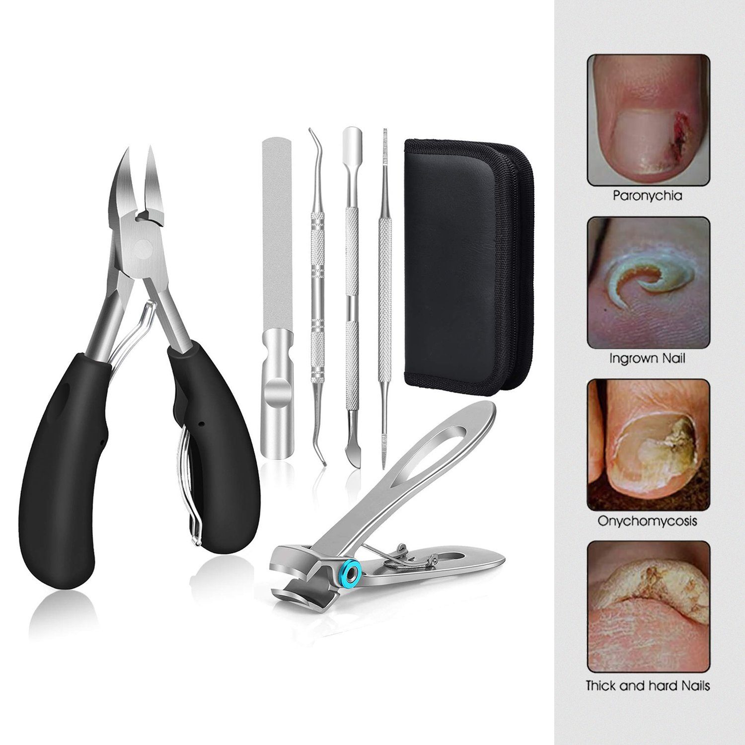 SOEKAVIA Nagelknipser-Set, Super scharf Nagelzange für Dicken & Eingewachsenen Harten Fußnägel, Profi Fußnagel Nagelknipser, Nagelfeile und Weicher Griff Nagelschere Set