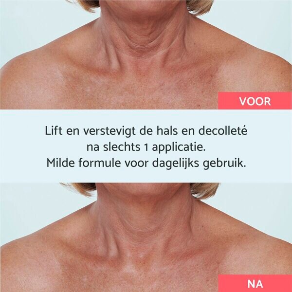 Remescar Hals & Decolleté krém 40 ml, minden bőrtípusra