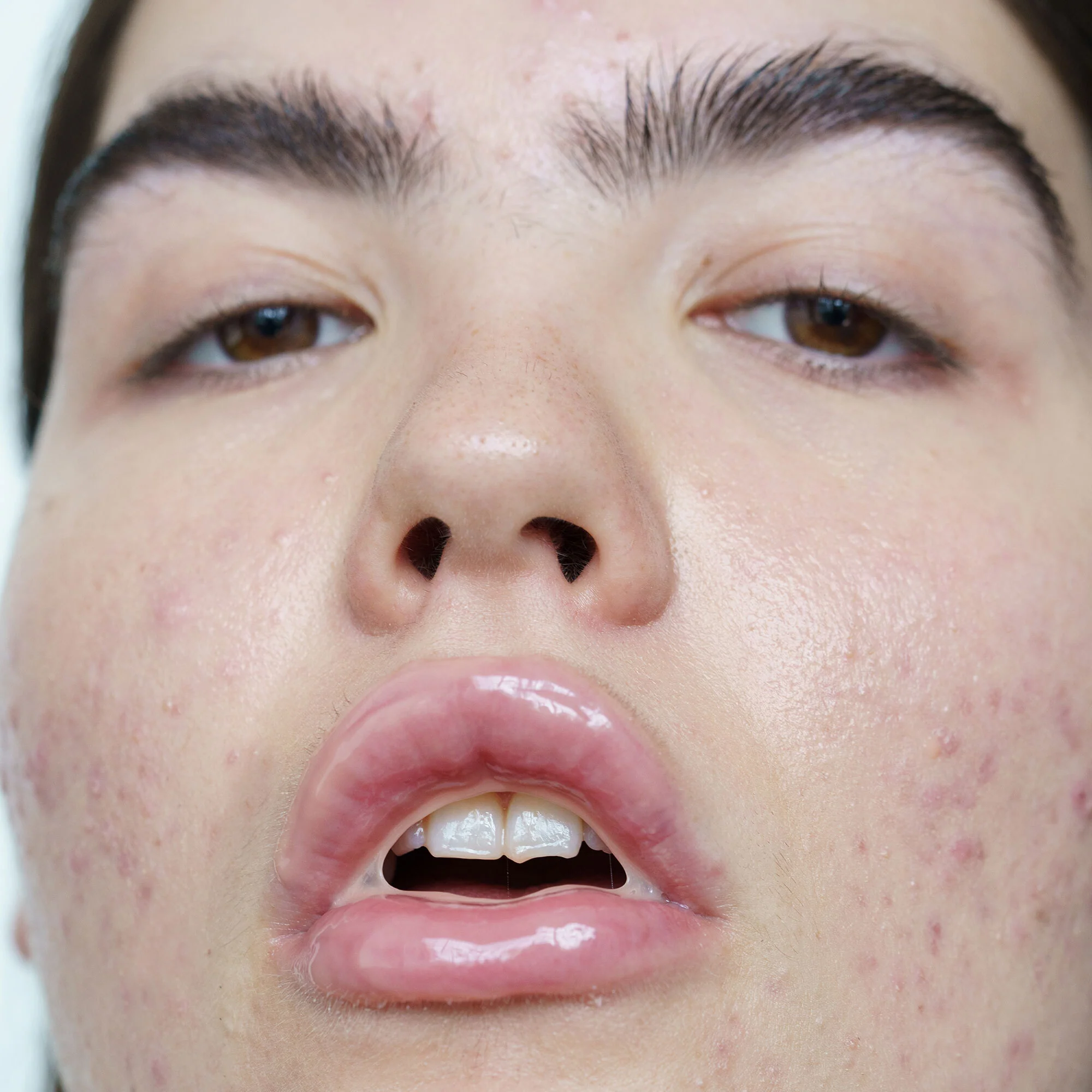 Lip-ME Nährende Lippenmaske – Lippenmaske, Lippenbalsam