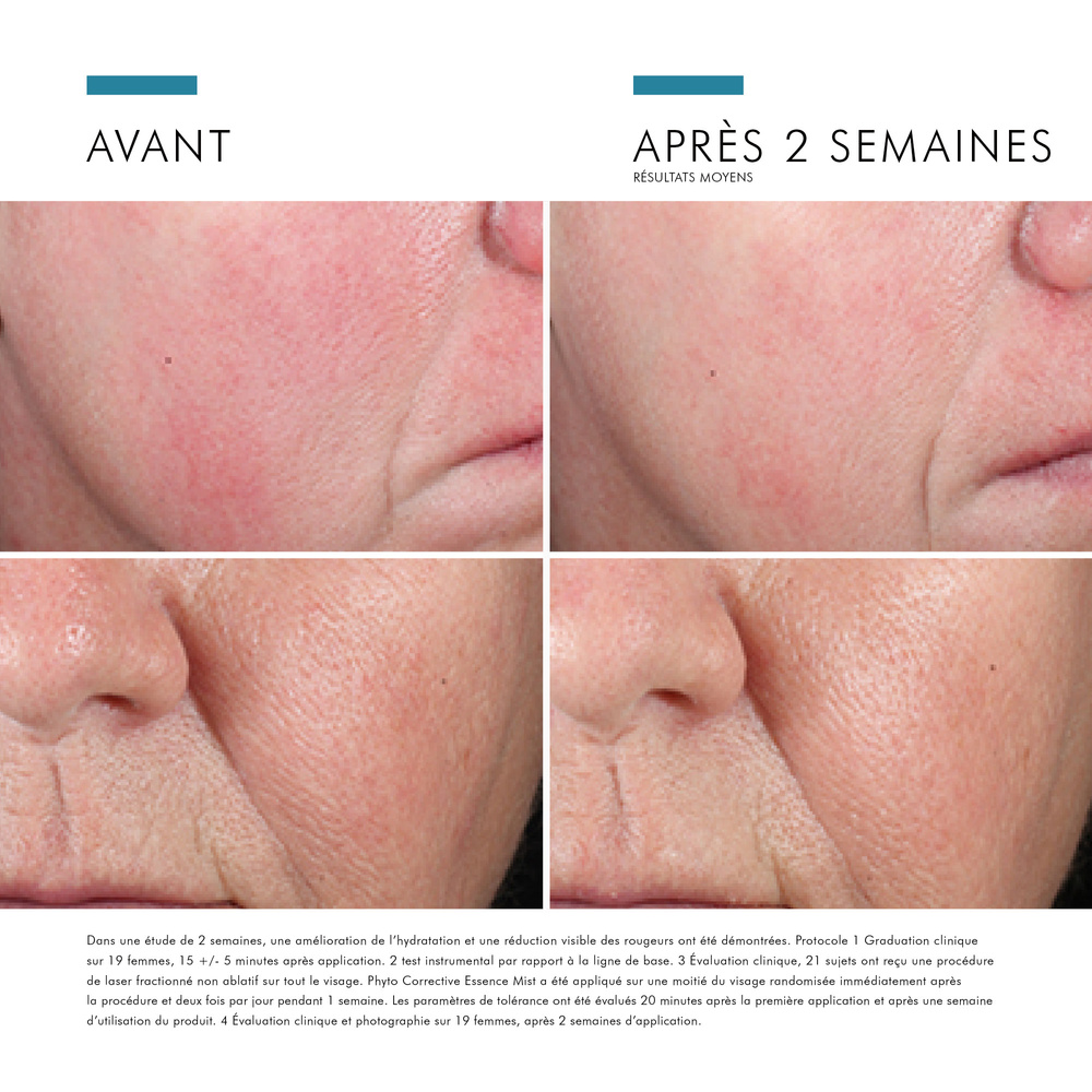 SkinCeuticals Phyto Corrective Brume hydratante Hautement concentrée en acide hyaluronique, apaise et réduit les rougeurs