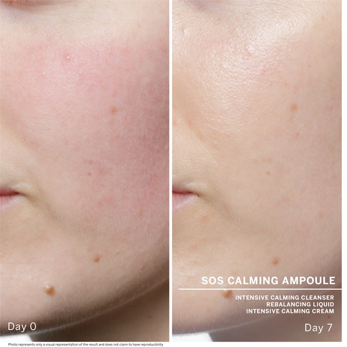 SOS Calming 7 Ampoules