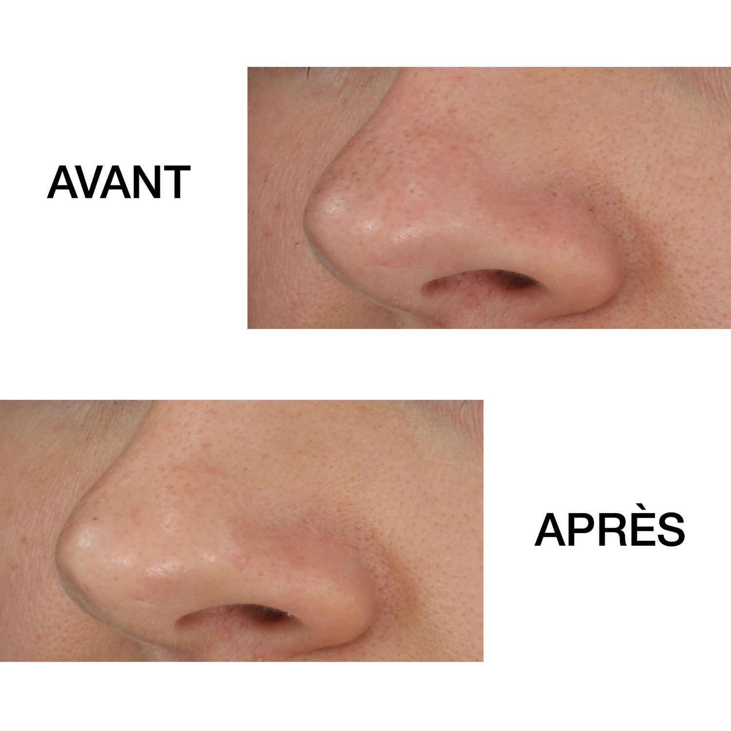 Clinique Blackhead Solutions Désincrustant Point Noirs Auto-Chauffant 20 ml