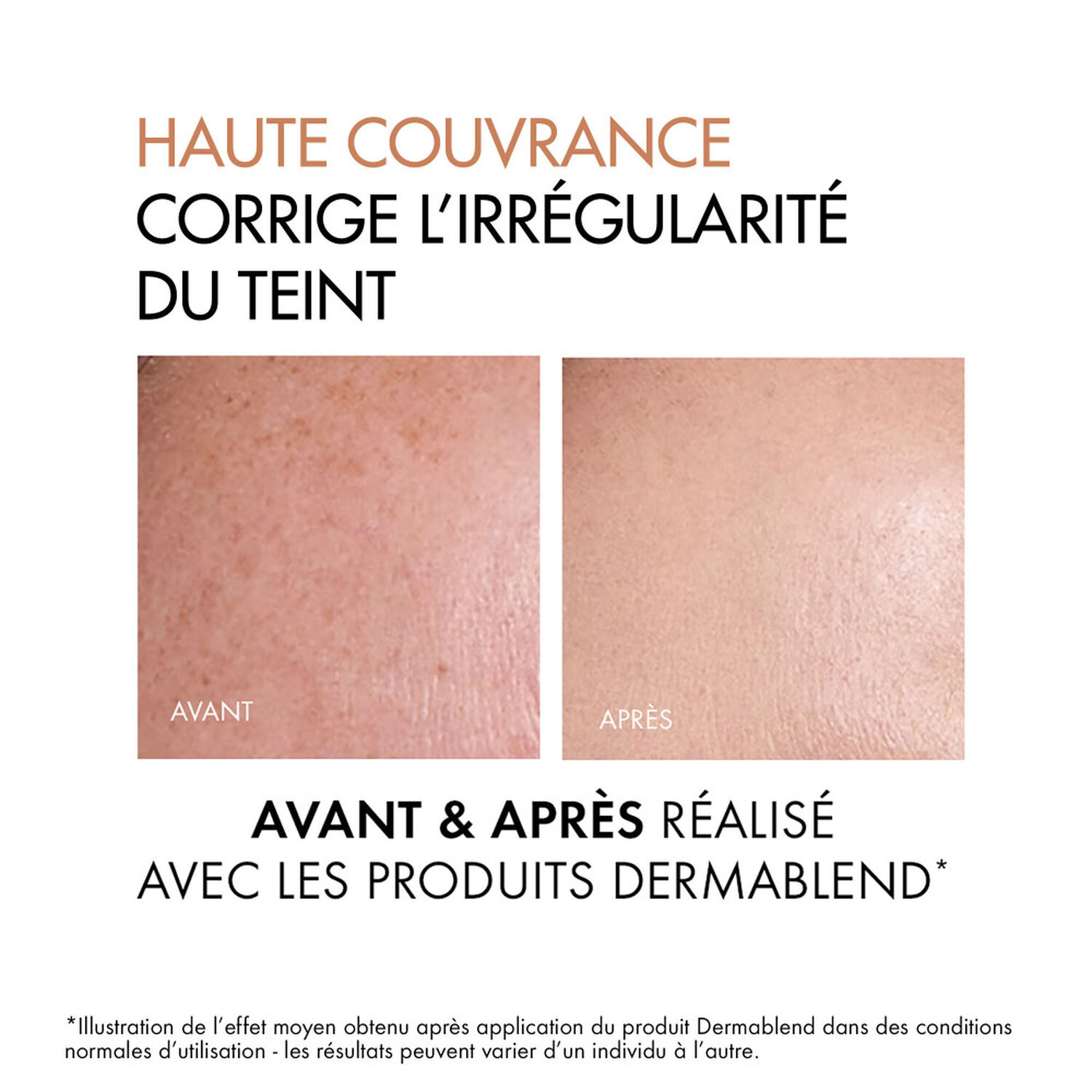Vichy Dermablend Fond de Teint Correcteur 16H - 30 ml