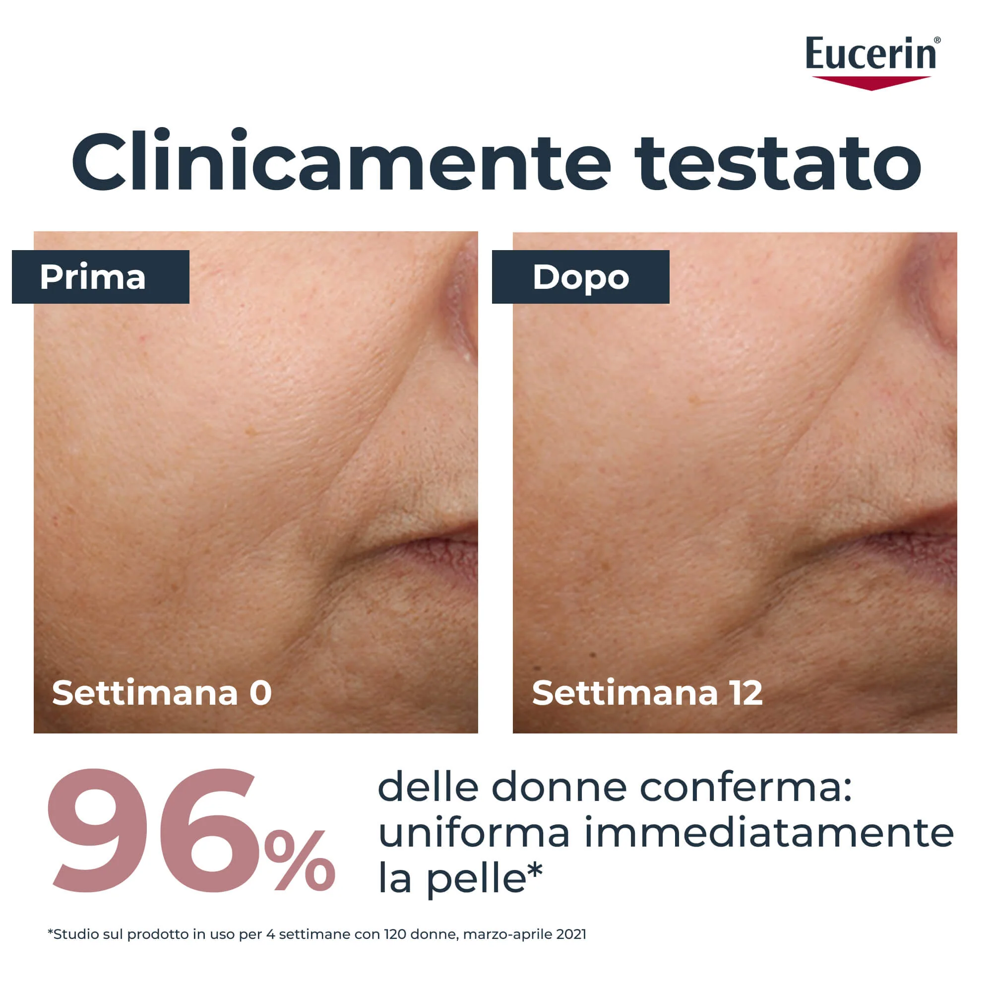Dieninis kremas nuo pigmentacijos SPF30 – tonuotas veido kremas nuo spuogų