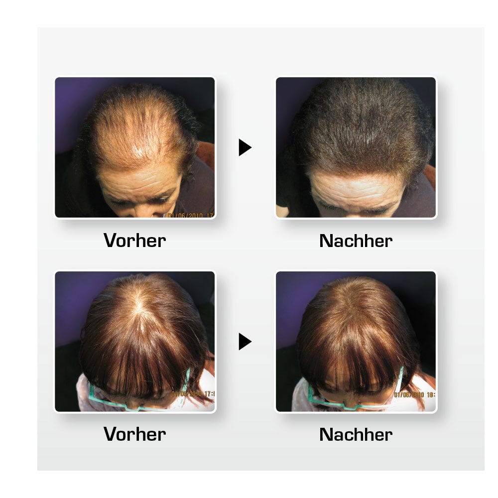 Biothik Haaraufbau-Faser S7 hellblond 15 g