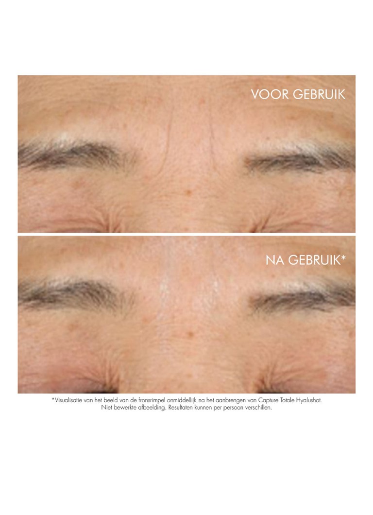 DIOR Capture Totale Hyalushot