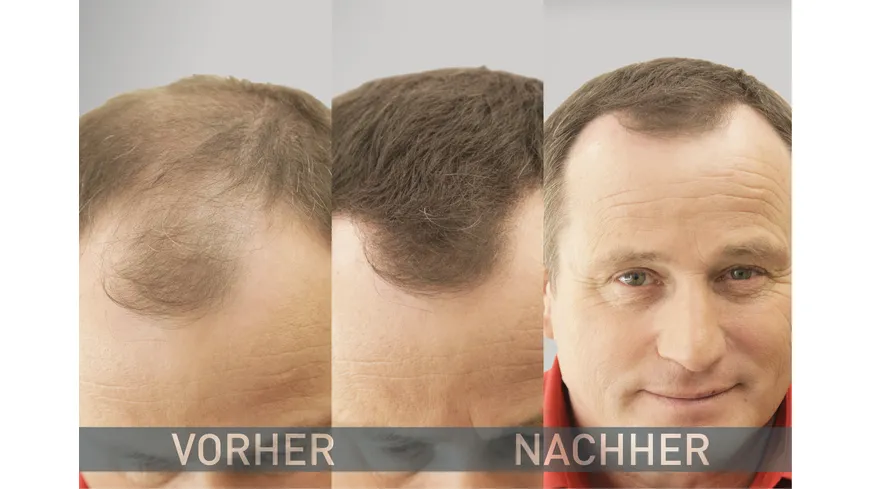 Cover Hair Streuhaar Haarverdichter 14 g medium brown
