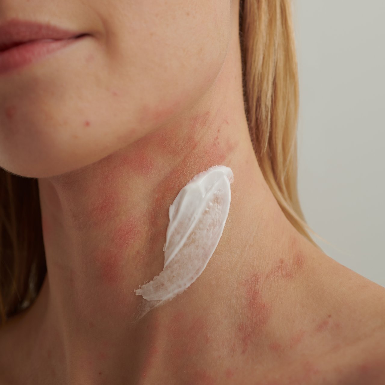 DADO SENS EXTRODERM Intensivcreme